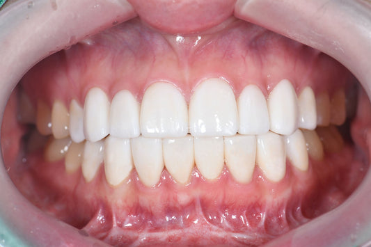 &nbsp;Is Korean Laminate Safe?