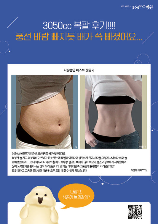 Korean Fat Contouring: Sculpting Your V-Line with Liposuction & Non-Surgical Fat Removal
