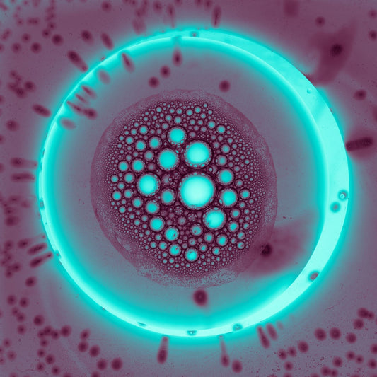 Bone Marrow Transplantation in South Korea: A Strategic Guide to Safety, Process, and Global Cost Efficiency
